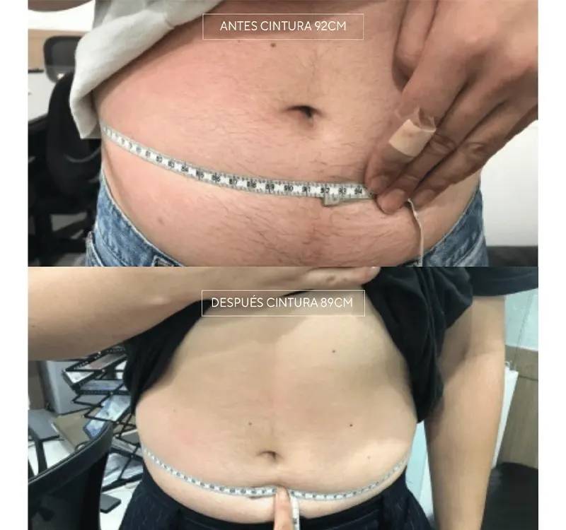 Img-Dra_Alejandra_Guzmán-Tecnología-Contour_Pro-2
