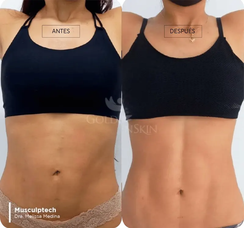 Img-Dra_Alejandra_Guzmán-Tecnología-Musculptech-10