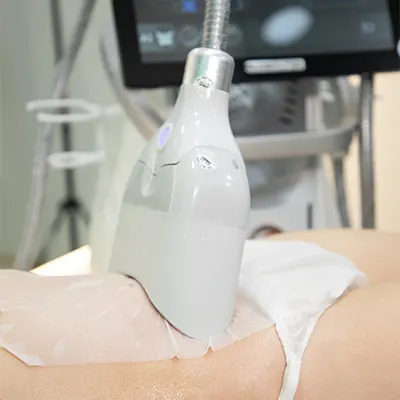 img-criolipolisis-en-bucaramanga-1-LCP